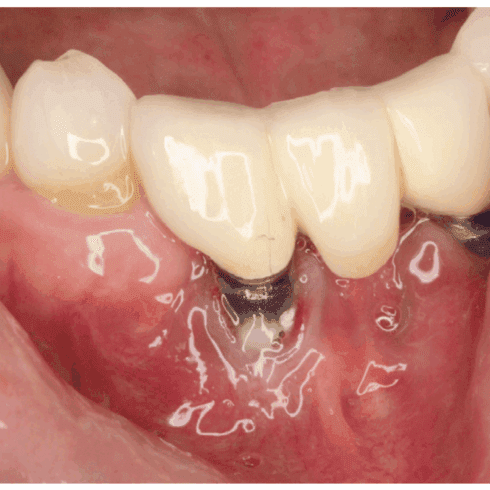 Skjermbilde 2025-06-23 kl. 10.00.15